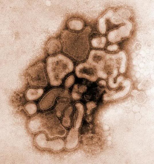 The H1N1 Virus.
