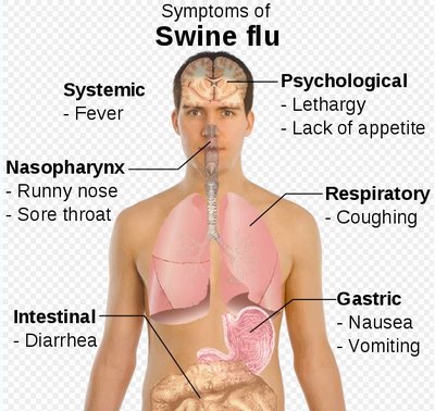 symptoms of swine flu